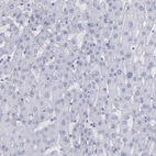 Immunohistochemical staining of human liver shows no positivity in hepatocytes as expected.