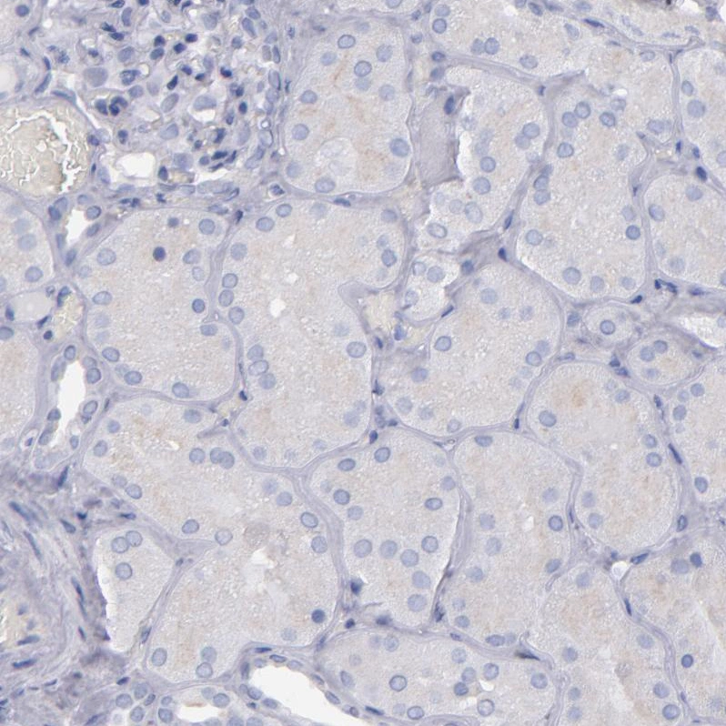 IRF8 (U4) Rabbit mAb