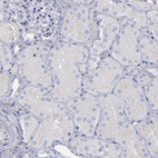 Anti-IRF8 Antibody