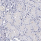 Immunohistochemical staining of human kidney shows no positivity in cells in tubules as expected.