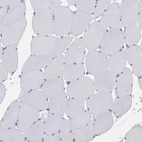 Immunohistochemical staining of human skeletal muscle shows no positivity in myocytes as expected.