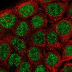 Immunofluorescent staining of human cell line CACO-2 shows localization to nucleoplasm.