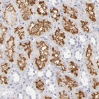 Immunohistochemical staining of human kidney shows strong membranous positivity in cells in tubules.