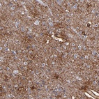 Anti-PLSCR4 Antibody