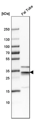 Western blot analysis in human fallopian tube tissue.