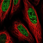 Immunofluorescent staining of human cell line SiHa shows localization to nucleoplasm & nuclear bodies.
