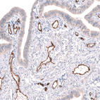 Anti-PLVAP Antibody