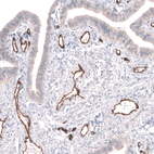 Immunohistochemical staining of human fallopian tube shows strong membranous positivity in endothelial cells.