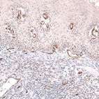 Immunohistochemical staining of human tonsil shows strong membranous positivity in endothelial cells.