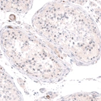 Immunohistochemical staining of human testis shows no positivity in cells in seminiferous ducts as expected.