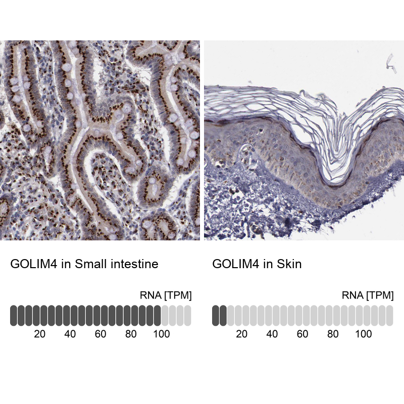 Anti-GOLIM4 Antibody