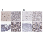 Immunohistochemical staining of human cerebral cortex, liver, skin and small intestine using Anti-GOLIM4 antibody HPA002315 (A) shows similar protein distribution across tissues to independent antibody HPA001677 (B).