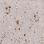 Anti-GOLIM4 Antibody