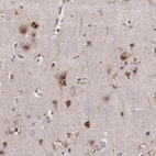 Immunohistochemical staining of human cerebral cortex shows strong granular cytoplasmic positivity in neurons and glial cells.