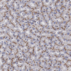 Immunohistochemical staining of human liver shows strong granular cytoplasmic positivity in hepatocytes.