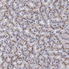 Immunohistochemical staining of human liver shows strong granular cytoplasmic positivity in hepatocytes.