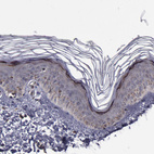 Anti-GOLIM4 Antibody