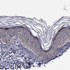 Immunohistochemical staining of human skin shows moderate granular cytoplasmic positivity in a small subset of squamous epithelial cells.
