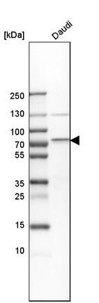 Anti-BIRC3 Antibody