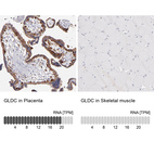 Anti-GLDC Antibody