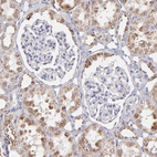 Anti-GLDC Antibody