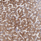 Immunohistochemical staining of human liver shows strong granular positivity in cytoplasm in hepatocytes.