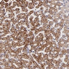 Immunohistochemical staining of human liver shows strong granular positivity in cytoplasm in hepatocytes.