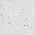 Immunohistochemical staining of human skeletal muscle shows no positivity in myocytes as expected.