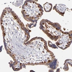 Immunohistochemical staining of human placenta shows strong granular positivity in cytoplasm in trophoblastic cells.