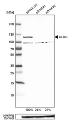 Western blot analysis in Caco-2 cells transfected with control siRNA, target specific siRNA probe #1 and #2, using Anti-GLDC antibody. Remaining relative intensity is presented. Loading control: Anti-GAPDH.