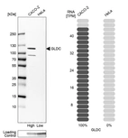Western blot analysis in human cell lines Caco-2 and HeLa using Anti-GLDC antibody. Corresponding GLDC RNA-seq data are presented for the same cell lines. Loading control: Anti-GAPDH.