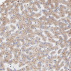 Anti-LMAN1 Antibody