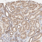Immunohistochemical staining of human kidney shows moderate granular cytoplasmic positivity in cells in tubules.