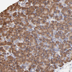 Anti-LMAN1 Antibody