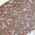 Immunohistochemical staining of human pancreas shows moderate granular cytoplasmic positivity in exocrine glandular cells.