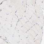 Immunohistochemical staining of human skeletal muscle shows no positivity in myocytes as expected.