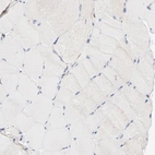 Immunohistochemical staining of human skeletal muscle shows no positivity in myocytes as expected.