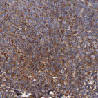 Immunohistochemical staining of human tonsil shows moderate cytoplasmic positivity in non-germinal center cells.