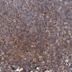 Immunohistochemical staining of human tonsil shows moderate cytoplasmic positivity in non-germinal center cells.