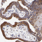 Immunohistochemical staining of human placenta shows strong cytoplasmic positivity in trophoblastic cells.