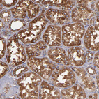 Immunohistochemical staining of human kidney shows strong cytoplasmic positivity in cells in tubules.
