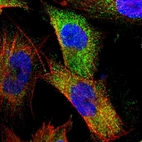 Immunofluorescent staining of human cell line U-251 MG shows localization to cytosol.