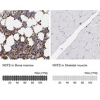 Anti-NCF2 Antibody