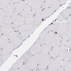 Immunohistochemical staining of human skeletal muscle shows low expression as expected.
