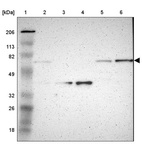 Lane 1: Marker [kDa] 206, 113, 82, 49, 32, 26, 18_br/_Lane 2: Human cell line RT-4_br/_Lane 3: Human cell line U-251MG sp_br/_Lane 4: Human cell line A-431_br/_Lane 5: Human liver tissue_br/_Lane 6: Human tonsil tissue