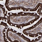 Immunohistochemical staining of human duodenum shows strong granular cytoplasmic positivity in glandular cells.