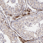 Anti-MAOB Antibody