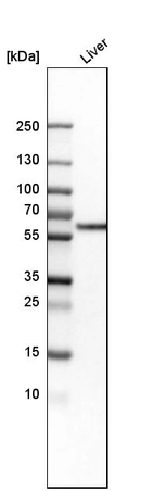 Western blot analysis in human liver tissue.