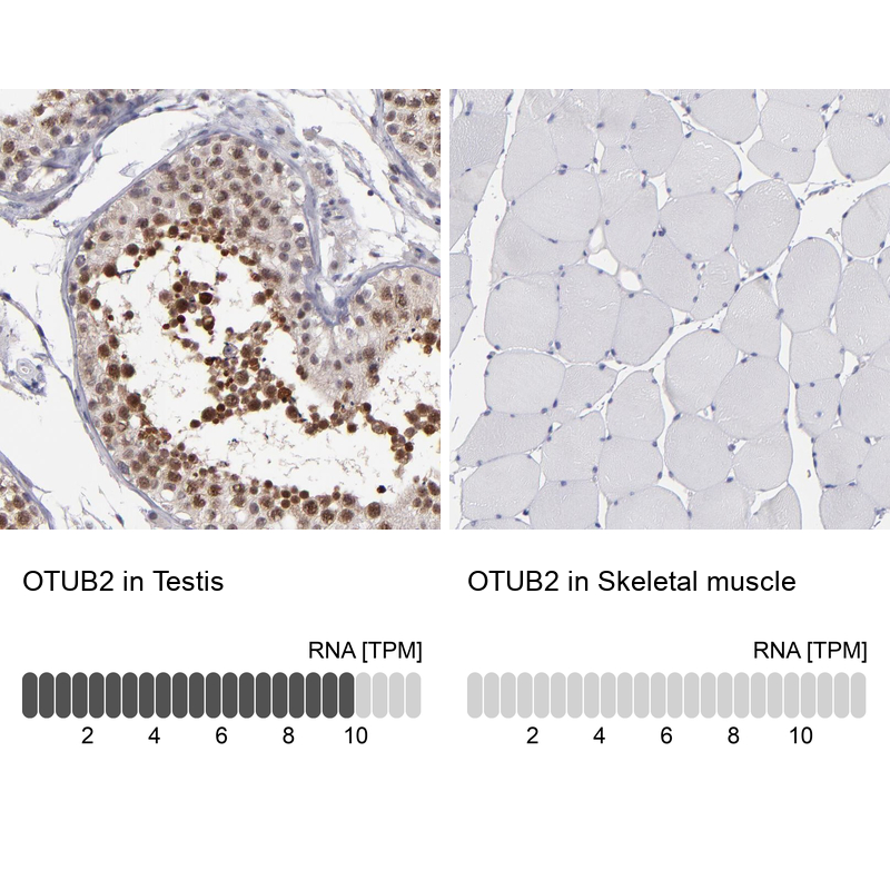 Anti-OTUB2 Antibody