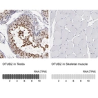 Anti-OTUB2 Antibody
